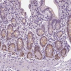 Anti-SOX9 Antibody