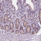 Immunohistochemical staining of human small intestine shows moderate nuclear positivity in a subset of glandular cells.