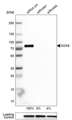 Western blot analysis in U-251MG cells transfected with control siRNA, target specific siRNA probe #1 and #2, using Anti-SOX9 antibody. Remaining relative intensity is presented. Loading control: Anti-GAPDH.