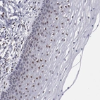 Immunohistochemical staining of human cervix, uterine shows moderate nuclear positivity in squamous epithelial cells.