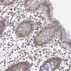 Immunohistochemical staining of human colon shows moderate nuclear positivity in glandular cells.