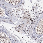 Immunohistochemical staining of human testis shows moderate nuclear positivity in Leydig cells.