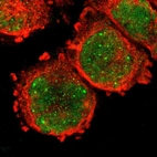 Immunofluorescent staining of human cell line A-431 shows localization to nucleus & nuclear bodies.