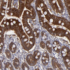 Anti-SEMA3G Antibody