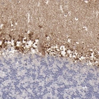 Immunohistochemical staining of human cerebellum shows moderate positivity in neuropil.