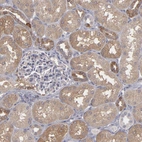 Immunohistochemical staining of human kidney shows weak to moderate cytoplasmic positivity in cells in tubules.