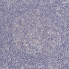 Immunohistochemical staining of human tonsil shows no positivity as expected.