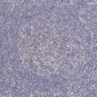 Immunohistochemical staining of human tonsil shows no positivity as expected.