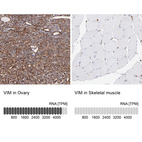 Anti-VIM Antibody