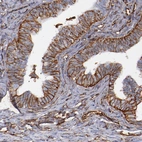 Immunohistochemical staining of human fallopian tube shows moderate membranous positivity in glandular cells.