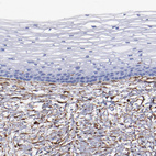 Immunohistochemical staining of human cervix, uterine shows moderate cytoplasmic positivity in stromal cells.