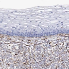Immunohistochemical staining of human cervix, uterine shows moderate cytoplasmic positivity in stromal cells.
