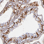 Immunohistochemical staining of human testis shows strong membranous positivity in cells in seminiferous ducts.