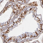 Immunohistochemical staining of human testis shows strong membranous positivity in cells in seminiferous ducts.