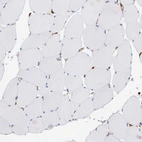 Immunohistochemical staining of human skeletal muscle shows no positivity in myocytes.