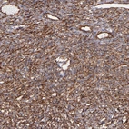 Immunohistochemical staining of human ovary shows moderate cytoplasmic positivity in stromal cells.