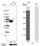 Western blot analysis in human cell lines U-251MG and MCF-7 using Anti-VIM antibody. Corresponding VIM RNA-seq data are presented for the same cell lines. Loading control: Anti-GAPDH.