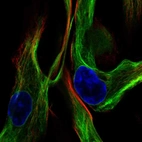 Immunofluorescent staining of human cell line ASC TERT1 shows localization to intermediate filaments.