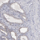 Immunohistochemical staining of human prostate shows moderate granular cytoplasmic positivity in glandular cells.
