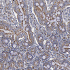 Anti-MYOM2 Antibody