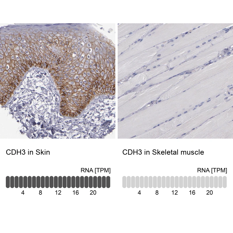 Rabbit Polyclonal Anti-CDH3 Antibody - Buy for research - Highly ...