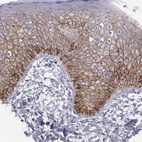 Immunohistochemical staining of human skin shows moderate membranous positivity in squamous epithelial cells.