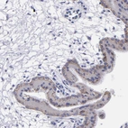 Immunohistochemical staining of human placenta shows moderate membranous positivity in trophoblastic cells.