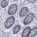 Immunohistochemical staining of human colon shows weak membranous positivity in glandular cells.