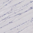 Immunohistochemical staining of human skeletal muscle shows no membranous positivity in myocytes as expected.