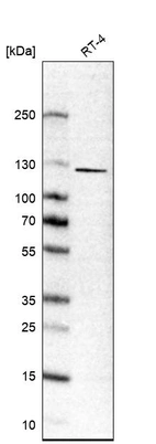 Western blot analysis in human cell line RT-4.