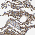 Anti-MYO1C Antibody