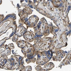 Immunohistochemical staining of human placenta shows strong membranous positivity in endothelial cells.