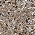Immunohistochemical staining of human stomach shows strong membranous positivity in glandular cells.