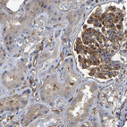 Anti-MYO1C Antibody