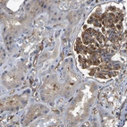 Immunohistochemical staining of human kidney shows strong membranous positivity in cells in glomeruli.