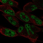 Anti-LIN52 Antibody