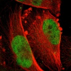 Anti-RPS6KA5 Antibody