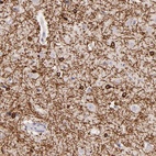 Anti-ZC3H7B Antibody