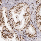 Anti-PAPOLA Antibody