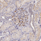 Immunohistochemical staining of human kidney shows strong cytoplasmic positivity in cells in glomeruli.