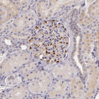 Anti-C14orf37 Antibody