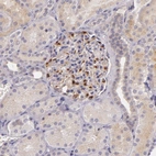 Immunohistochemical staining of human kidney shows strong cytoplasmic positivity in cells in glomeruli.