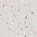 Immunohistochemical staining of human cerebral cortex shows moderate cytoplasmic positivity in neurons.