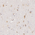 Anti-C14orf37 Antibody