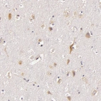 Immunohistochemical staining of human cerebral cortex shows moderate cytoplasmic positivity in neurons.