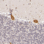 Immunohistochemical staining of human cerebellum shows strong cytoplasmic positivity in Purkinje cells.