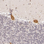 Immunohistochemical staining of human cerebellum shows strong cytoplasmic positivity in Purkinje cells.