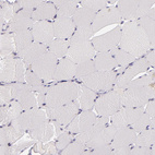 Immunohistochemical staining of human skeletal muscle shows no positivity in myocytes as expected.