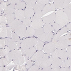 Immunohistochemical staining of human skeletal muscle shows no positivity in myocytes as expected.
