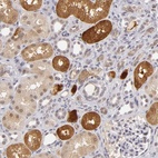 Anti-ZNF205 Antibody